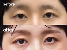 エンバー 吉祥寺(embr.)/【アイブロウ/メイク/眉毛】