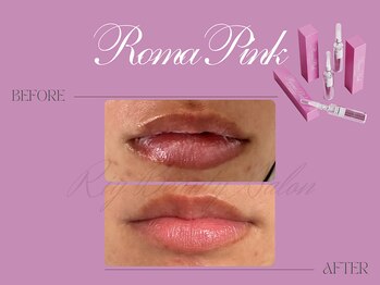 リー(Riy)/《Before and After》