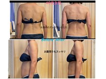 ヌーボ(NUeVo)/背中のズレも整う