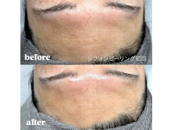 ウィズティ(with.T)/シフォンピーリング