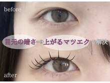 アイラッシュサロン ウインクル(Eyelash Salon Winkle)/下がりまつ毛が気になる方へ