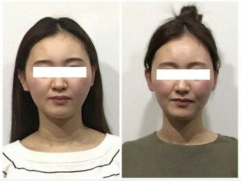 シンメトリー 麻布十番/Before/After
