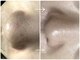 プレローマ(Pleroma)の写真