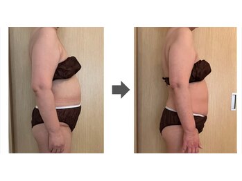 ルルラ(Rulula)の写真/気になるぽっこりお腹を徹底引き締め！理想のくびれを目指すなら結果重視の「ヴィーナスディーバ」にお任せ
