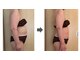 ルルラ(Rulula)の写真/気になるぽっこりお腹を徹底引き締め！理想のくびれを目指すなら結果重視の「ヴィーナスディーバ」にお任せ
