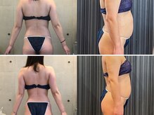 エクセレントビューティーサロン 艶(EN)の雰囲気（VENUSLEGACY 唯一無二のBODY形成・サイズダウン減量プログラム）