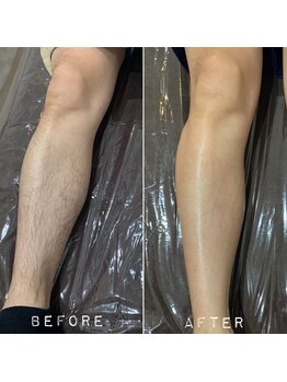 デザインファム(DESIGN FAM)/両膝下ワックス脱毛