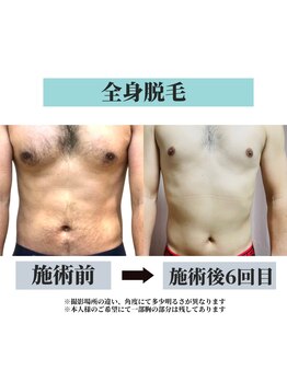 オリオンドットエスツー(Orion.S2)/【Before→After】