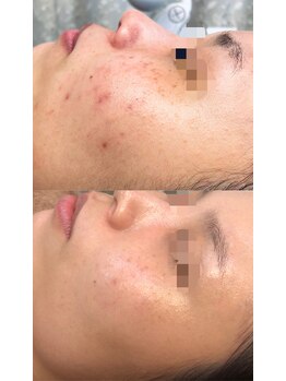 ドルフィン(Dolphin)/★お客様ビフォーアフター