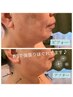【大人気】引き上げ／ストレス噛み締めにも◎EMSリフティング＋美骨60¥8500