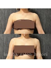 ヒヨリ(hiyori)/《before/after》上半身