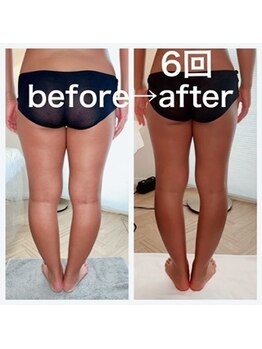 ウラヤス 恵比寿(Urayasu)/腸腰筋ケア入れながら下半身痩せ