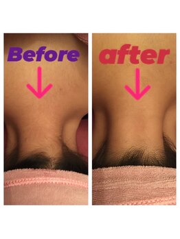 アンリール 旭川店(Anrire)/脱毛でご来店のお客様です!