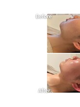 エムボーテ 太田店(M BEAUTE33)/顔筋小顔コルギ