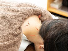 リ・ムーヴ鍼灸整体院　大宮駅前院/☆鍼灸施術