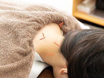 リ・ムーヴ鍼灸整体院　大宮駅前院/☆鍼灸施術