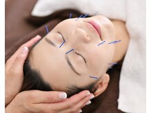 スリー治療院 伏見桃山(THREE治療院)/【弾力・エイジングケア】美容鍼