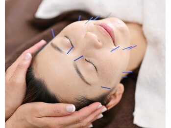 スリー治療院 伏見桃山(THREE治療院)/【弾力・エイジングケア】美容鍼