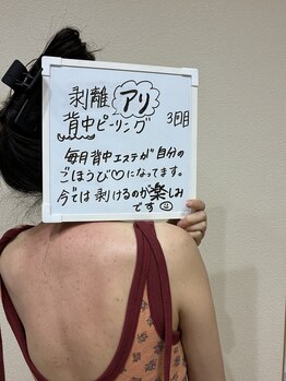 ブロッサム(Blossom)/剥離ありハーブピーリング背中