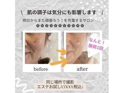 メナードフェイシャルサロン ビアンカガーデンの写真