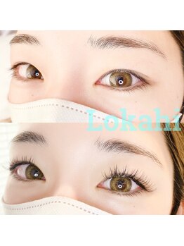 ロカヒ(Lokahi)/＊before after＊