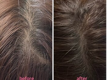 シャルム(charme)/ケアエク