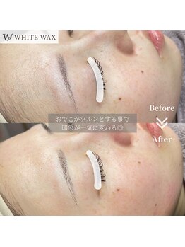ホワイトワックス 浜松(WHITE WAX)/ごわつくお肌をワックスで解消