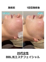 サロンアメリ 高松丸亀町店(Salon Ameri)/香川　高松　エステ　アメリ