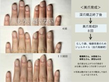 クウ(KUU)/爪にも停滞期がある