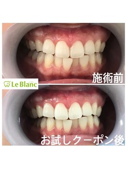 ルブラン 奈良店(Le Blanc)/汚いなって思われないように。。