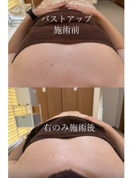 ノエ(Noe)/ハリのある胸を取り戻しましょう