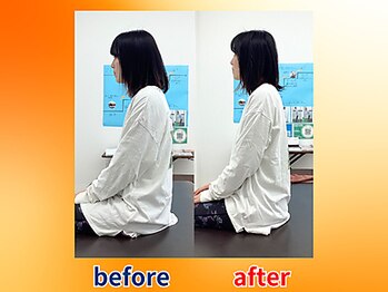 ストレッチヒーロー 広島中広店/姿勢のビフォーアフター