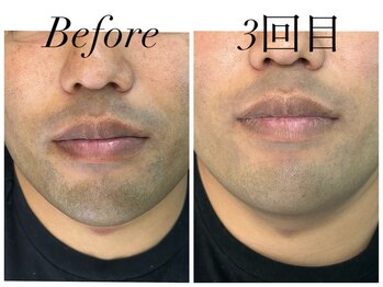 フェリーチェ 海老名(Felice)/