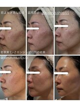 ティラ(Tira)/若よもぎ蒸し☆連続12日間