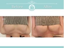 美人バスト 新潟店/ 【バストアップ★育乳】症例