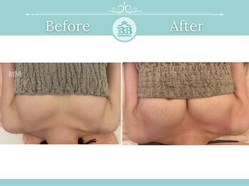 美人バスト 新潟店/ 【バストアップ★育乳】症例