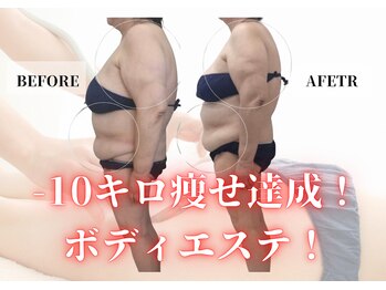 リヴェーヌ 呉羽店(Riverne)の写真/夏までにボディラインを変えたい人必見！リヴェーヌ10年以上活躍自慢の筋膜リリースにお任せ！