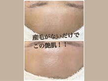 ウェリナポノビューティサロン(welina pono beauty salon)/《小顔/毛穴/脱毛》