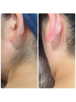 リラックススペース アーク(relax space Arc)/シュガーリング 脱毛