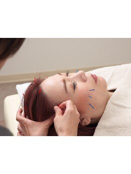 鍼灸施術を受けたい