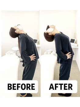 整体ライト 八事店(整体LIGHT)/施術後の変化