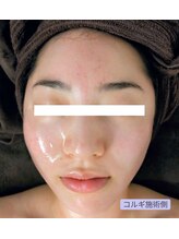 ボディーワークスナビ(Body Works Navi)/小顔矯正コルギ＆レモンボトル