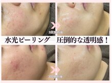 ミレット(Miretto)