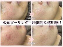 ミレット(Miretto)