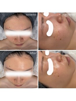 ビオエル(Bioell)/キメの整ったハリツヤ肌へ♪♪