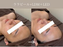 リィ プラス(Riii plus)/【韓国陶器肌】