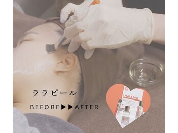 アンドエピ(&epi)/