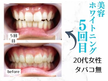 ルカノン(le canon)/写真撮影が楽しくなりました☆彡