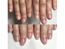 イズム(Izm)/上before/下after