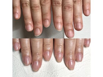 イズム(Izm)/上before/下after